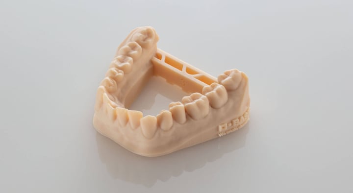 Resina Ultracur3D da Forward-AM aplicada em peça dental