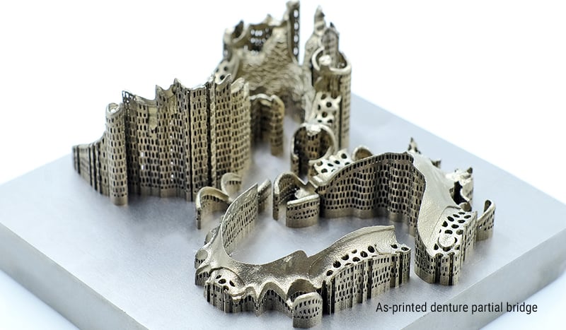 Ponte dentária em cobalto-cromo CoCrMo impressa em 3D por SLM